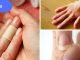 9 საშიში დაავადება,რომელსაც მიხვდებით თქვენს ხელებზე დაკვირვებით.