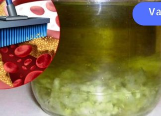 ტიბეტური რეცეპტი ნივრით სისხლძარღვების გასაწმენდად. გაუმჯობესდა მეხსიერება და თავის ტკივილი გაქრება.