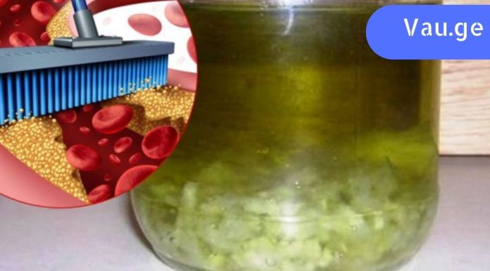 ტიბეტური რეცეპტი ნივრით სისხლძარღვების გასაწმენდად. გაუმჯობესდა მეხსიერება და თავის ტკივილი გაქრება.