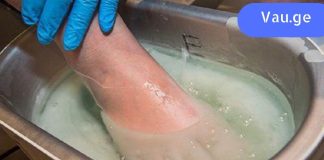 სოკო გაქრება! აიღეთ დაგამოიყენეთ ეს მეთოდები.