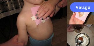 დედამ ეს კომპრესა ბავშვს ღამით გაუკეთა. რაც დღეს დილით მოხდა, საოცარია!