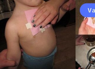 დედამ ეს კომპრესა ბავშვს ღამით გაუკეთა. რაც დღეს დილით მოხდა, საოცარია!