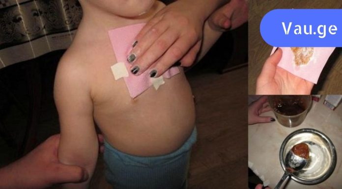 დედამ ეს კომპრესა ბავშვს ღამით გაუკეთა. რაც დღეს დილით მოხდა, საოცარია!