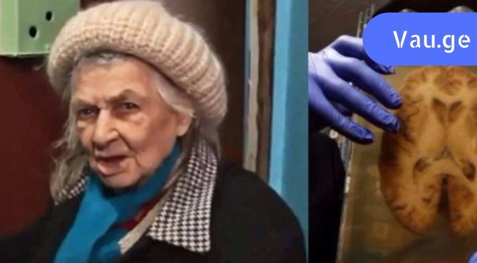 არასოდეს დასცინოთ ესეთ მოხუცებს,ეს ყველამ უნდა გავითვალისწინოთ, დიოგენეს სინდრომი – დაავადება, რომელიც თავს ესხმის მოხუცებს!