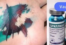 ბრილიანტის მწვანე – ამ ხსნარს საზღვარგარეთ არ იყენებენ!