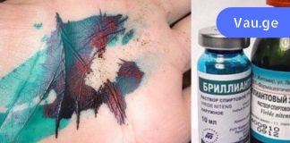 ბრილიანტის მწვანე – ამ ხსნარს საზღვარგარეთ არ იყენებენ!