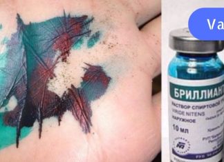 ბრილიანტის მწვანე – ამ ხსნარს საზღვარგარეთ არ იყენებენ!