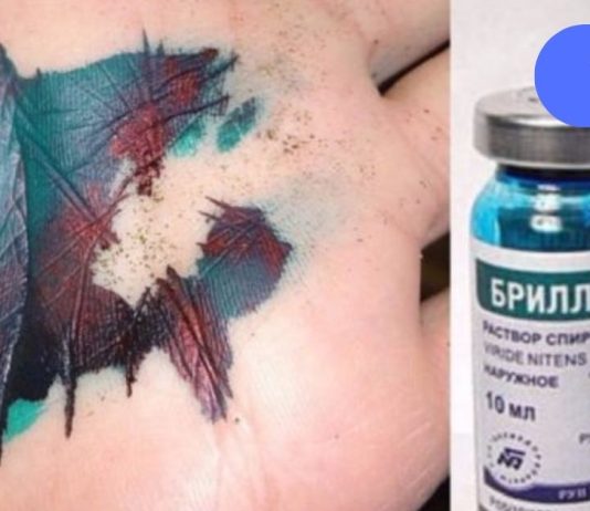 ბრილიანტის მწვანე – ამ ხსნარს საზღვარგარეთ არ იყენებენ!