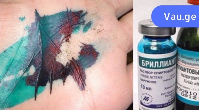 ბრილიანტის მწვანე – ამ ხსნარს საზღვარგარეთ არ იყენებენ!