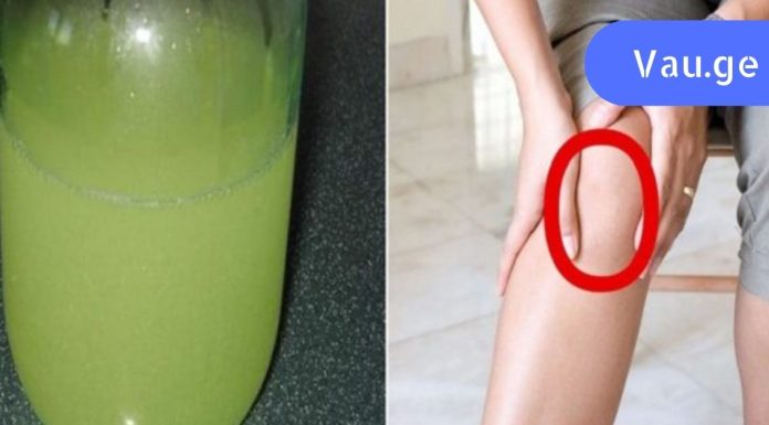 რევმატიზმმა გამიარა, როცა ამ მცენარის ნაყენი გავაკეთე! ეს ყველას აქვს  სახლში.