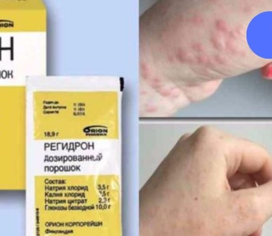 მე აღარ ვყიდულობ რეგიდრონს! გაიგეთ ამის მიზეზი.