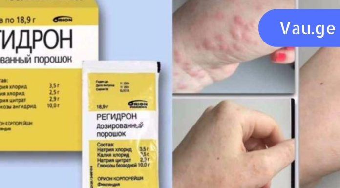 მე აღარ ვყიდულობ რეგიდრონს! გაიგეთ ამის მიზეზი.