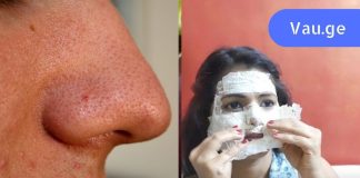 სასწაული ნიღაბი ადვილად მოაცილებს საძულველ შავ წერტილებს!