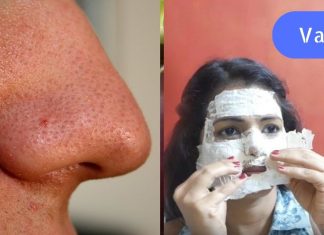 სასწაული ნიღაბი ადვილად მოაცილებს საძულველ შავ წერტილებს!