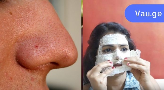 სასწაული ნიღაბი ადვილად მოაცილებს საძულველ შავ წერტილებს!