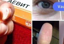 წამალი “აევიტი” სასწაულებს ახდენს! ეფექტურია ფრჩხილისთვის,თმისთვის და ….