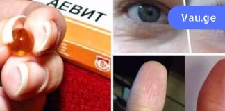 წამალი “აევიტი” სასწაულებს ახდენს! ეფექტურია ფრჩხილისთვის,თმისთვის და ….