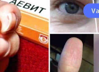 წამალი “აევიტი” სასწაულებს ახდენს! ეფექტურია ფრჩხილისთვის,თმისთვის და ….