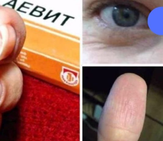 წამალი “აევიტი” სასწაულებს ახდენს! ეფექტურია ფრჩხილისთვის,თმისთვის და ….