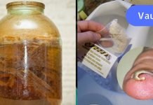 ბაბუის რჩევა ჩაზრდილი ფრჩხილის სამკურნალოდ. ერთხელ და სამუდამოდ მოიშორეთ ეს პრობლემა!