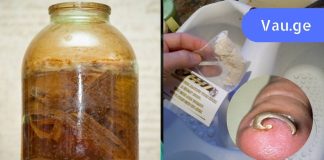 ბაბუის რჩევა ჩაზრდილი ფრჩხილის სამკურნალოდ. ერთხელ და სამუდამოდ მოიშორეთ ეს პრობლემა!