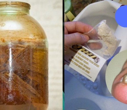 ბაბუის რჩევა ჩაზრდილი ფრჩხილის სამკურნალოდ. ერთხელ და სამუდამოდ მოიშორეთ ეს პრობლემა!