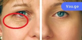 გაიგეთ რა ინგრედიენტები უნდა აურიოთ სახის ნაოჭების ნიღბისთვის. 4 სუპერ რეცეპტი!