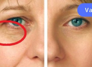 გაიგეთ რა ინგრედიენტები უნდა აურიოთ სახის ნაოჭების ნიღბისთვის. 4 სუპერ რეცეპტი!