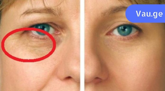 გაიგეთ რა ინგრედიენტები უნდა აურიოთ სახის ნაოჭების ნიღბისთვის. 4 სუპერ რეცეპტი!