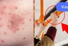 ფრთხილად! დღეს საზოგადოებრივ ტრანსპორტში საშინელი ინფექციები დადის… დაიცავით თავი!