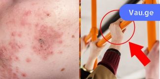 ფრთხილად! დღეს საზოგადოებრივ ტრანსპორტში საშინელი ინფექციები დადის… დაიცავით თავი!