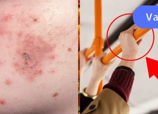 ფრთხილად! დღეს საზოგადოებრივ ტრანსპორტში საშინელი ინფექციები დადის… დაიცავით თავი!