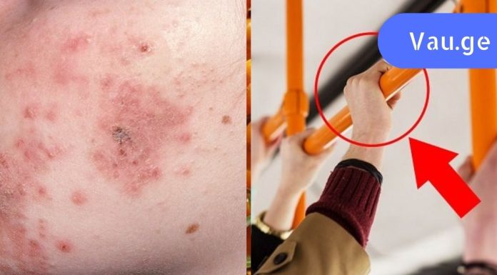 ფრთხილად! დღეს საზოგადოებრივ ტრანსპორტში საშინელი ინფექციები დადის… დაიცავით თავი!