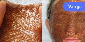 ჩემი კანი დიდი ხანია არ ყოფილა ასეთი მშვენიერი! მინდა გაგიზიაროთ ჩემი რეცეპტი