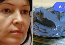 მოშვებული ლოყები? გაეცანით სახის კორექციის ეფექტურ მეთოდებს!