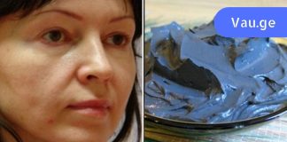 მოშვებული ლოყები? გაეცანით სახის კორექციის ეფექტურ მეთოდებს!