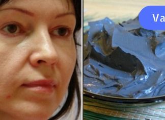 მოშვებული ლოყები? გაეცანით სახის კორექციის ეფექტურ მეთოდებს!