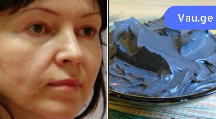 მოშვებული ლოყები? გაეცანით სახის კორექციის ეფექტურ მეთოდებს!