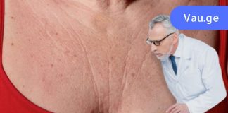 ეს საოცარი პროდუქტები აქრობს ნაოჭებს მკერდზე და კისერზე, მაშინვე იგრძნობთ ახალგაზრდობას, ქალბატონებო!