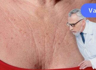 ეს საოცარი პროდუქტები აქრობს ნაოჭებს მკერდზე და კისერზე, მაშინვე იგრძნობთ ახალგაზრდობას, ქალბატონებო!