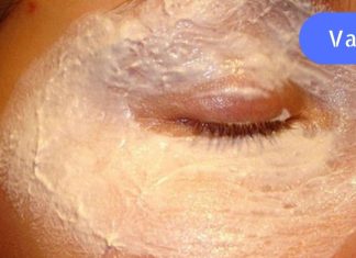 ქუთუთოები ნაოჭების გარეშე: გამოიყენეთ ეს მარტივი პროდუქტი და დაივიწყებთ დაბერებას!