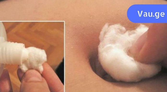 ყველაფერი რაც თქვენ უნდა გააკეთოთ არის ჭიპში ჩაიდეთ ალკოჰოლში დასველებული ბამბის ტამპონი! ხველა, გაციება ძალიან მალე გაქრება.