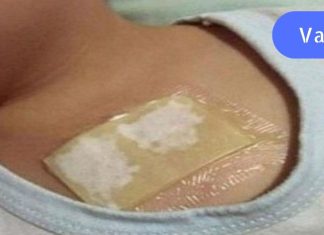 ხსნის ძლიერ ხველას და შლის ლორწოს ფილტვებიდან და ბრონქებიდან სულ რაღაც 1 ღამეში: ეს არის ხსნა.