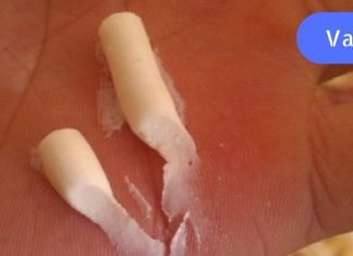 ბორო პლიუსი,ძალიან იაფი და კარგი საშუალება შენი კანისთვის