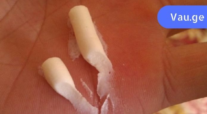 ბორო პლიუსი,ძალიან იაფი და კარგი საშუალება შენი კანისთვის