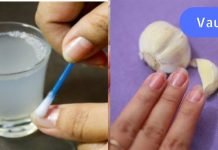 გაიჯანსაღეთ ფრჩხილები ამ 3 ინგრედიენტითიდმა