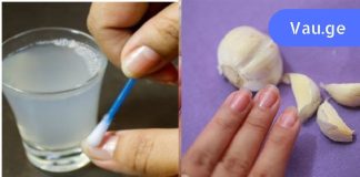გაიჯანსაღეთ ფრჩხილები ამ 3 ინგრედიენტითიდმა
