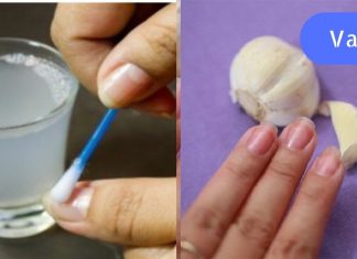 გაიჯანსაღეთ ფრჩხილები ამ 3 ინგრედიენტითიდმა