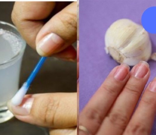 გაიჯანსაღეთ ფრჩხილები ამ 3 ინგრედიენტითიდმა