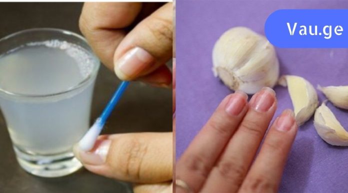 გაიჯანსაღეთ ფრჩხილები ამ 3 ინგრედიენტითიდმა